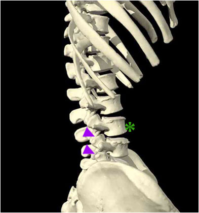 bony spine